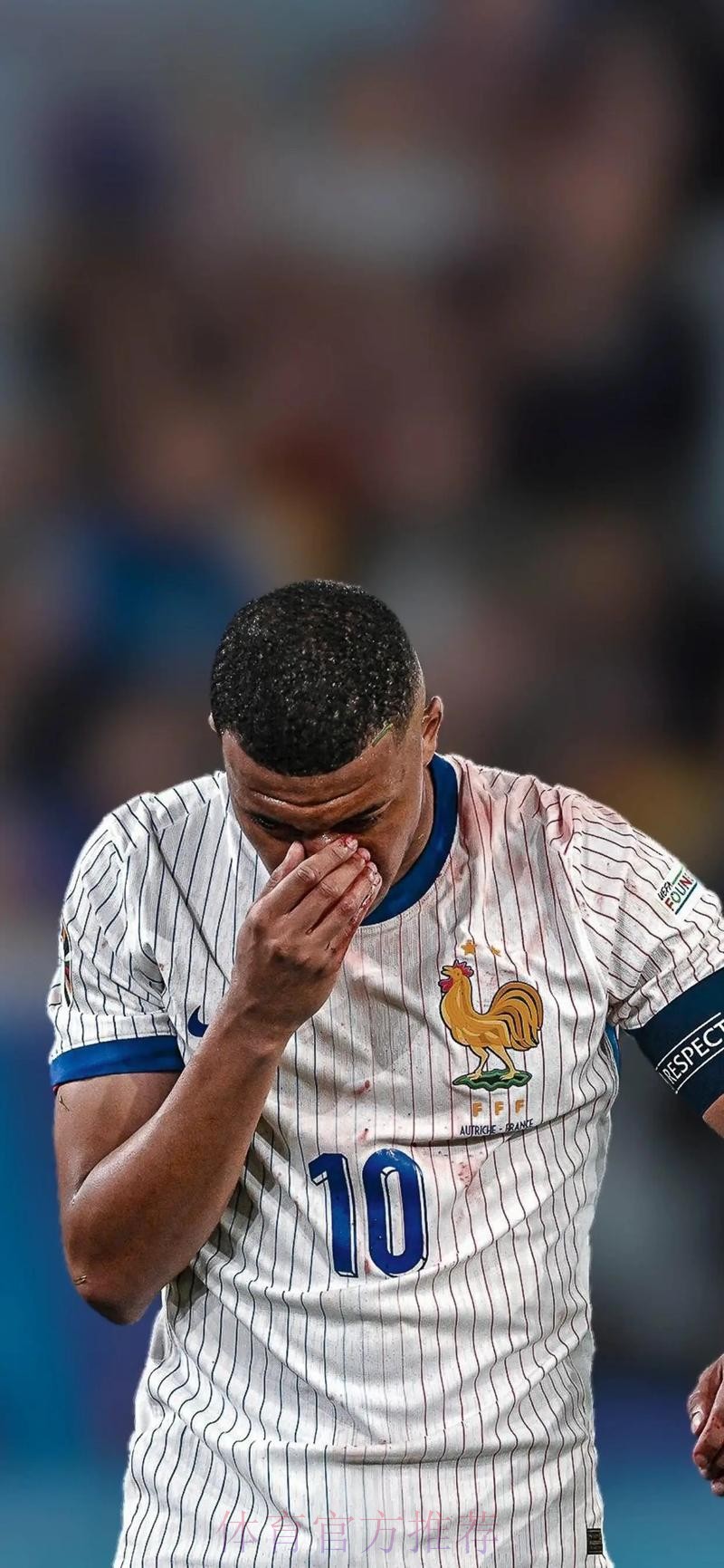 皇马担心姆巴佩鼻子骨折影响亮相 希望他接受手术